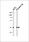 AKR1B1 Antibody (C-term)