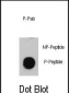 Phospho-ATM(S1981) Antibody