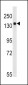 Tuberin (TSC2) Antibody (S1798)