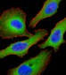 AP6348d-Tuberin-TSC2-Antibody-S1798