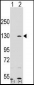 PARP1 Antibody (N-term)