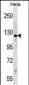 PARP1 Antibody (N-term)