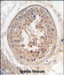 JLP (SPAG9) Antibody (Center)