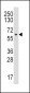 Aromatase (CYP19A1) Antibody (Center)