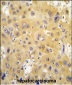 ECGF1 Antibody (Center)