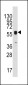 ECGF1 Antibody (Center)