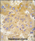 LAP3 Antibody (N-term)