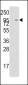 MIC1 Antibody (Center)