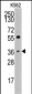 Thrombopoietin (TPO) Antibody (C-term)