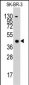 ACAT1 Antibody (C-term)