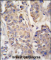 ACO2 Antibody (Center)