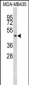 ILK Antibody (S343)