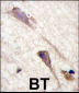 B-RAF Antibody (S601)