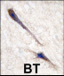 RAF1 (BRAF) Antibody (T598)