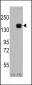 ASK1 (MEKK5/MAP3K5) Antibody (S966)