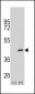 MEK4 (MAP2K4) Antibody (S257)