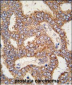 TRPM8 Antibody (C-term)