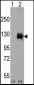 TRPM8 Antibody (C-term)