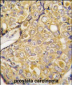 TRPM8 Antibody (Center R536)