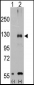 TRPM8 Antibody (Center R536)