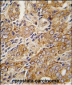 TRPM8 Antibody (C-term C940)