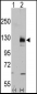 TRPM8 Antibody (C-term C940)