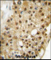 ELP3 Antibody (C-term)