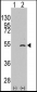 ELP3 Antibody (C-term)