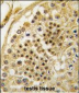 HBO1/MYST2 Antibody (N-term)