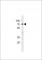 HBO1/MYST2 Antibody (N-term)