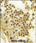 HBO1/MYST2 Antibody (Center)