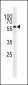 HBO1/MYST2 Antibody (Center)