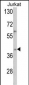 YBX2 Antibody (C-term)