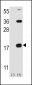 CD3Z Antibody (C-term)