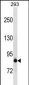 K Cadherin (CDH6) Antibody (N-term)