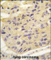 FRAT1 Antibody (Center)