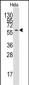 ATG16L Antibody