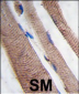 PI3KC3 Antibody (S34)