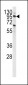 PI3KC3 Antibody (S851)