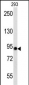 ACO2 Antibody (Center)