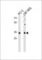 JUN Antibody (S63)