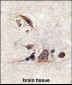 JUN Antibody (T243)