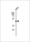 JUN Antibody (T243)