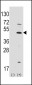 MATH1/HATH1/ATOH1 Antibody (C-term)