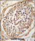 NPTX2 Antibody (Center)