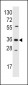 AKR1B1 Antibody (Center)