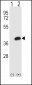 AKR1B1 Antibody (Center)