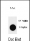 Phospho-ABL1(Y393)/ABL2(439)Antibody