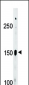 Phospho-ABL1(Y393)/ABL2(439)Antibody