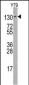 ABL2 Antibody (R432)